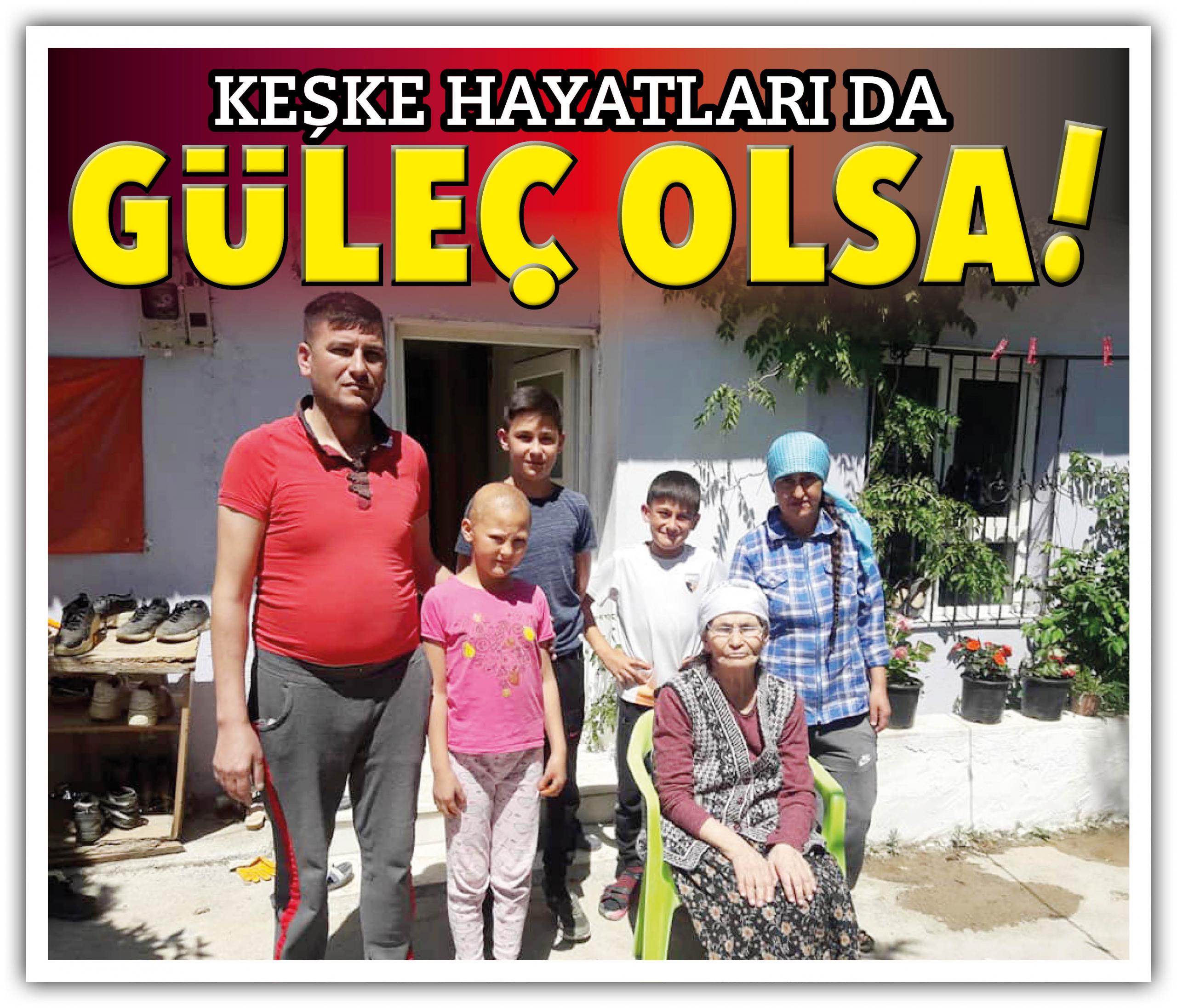 BABA EPİLEPSİ HASTASI KIZININ SAÇLARI ÇIKMIYOR