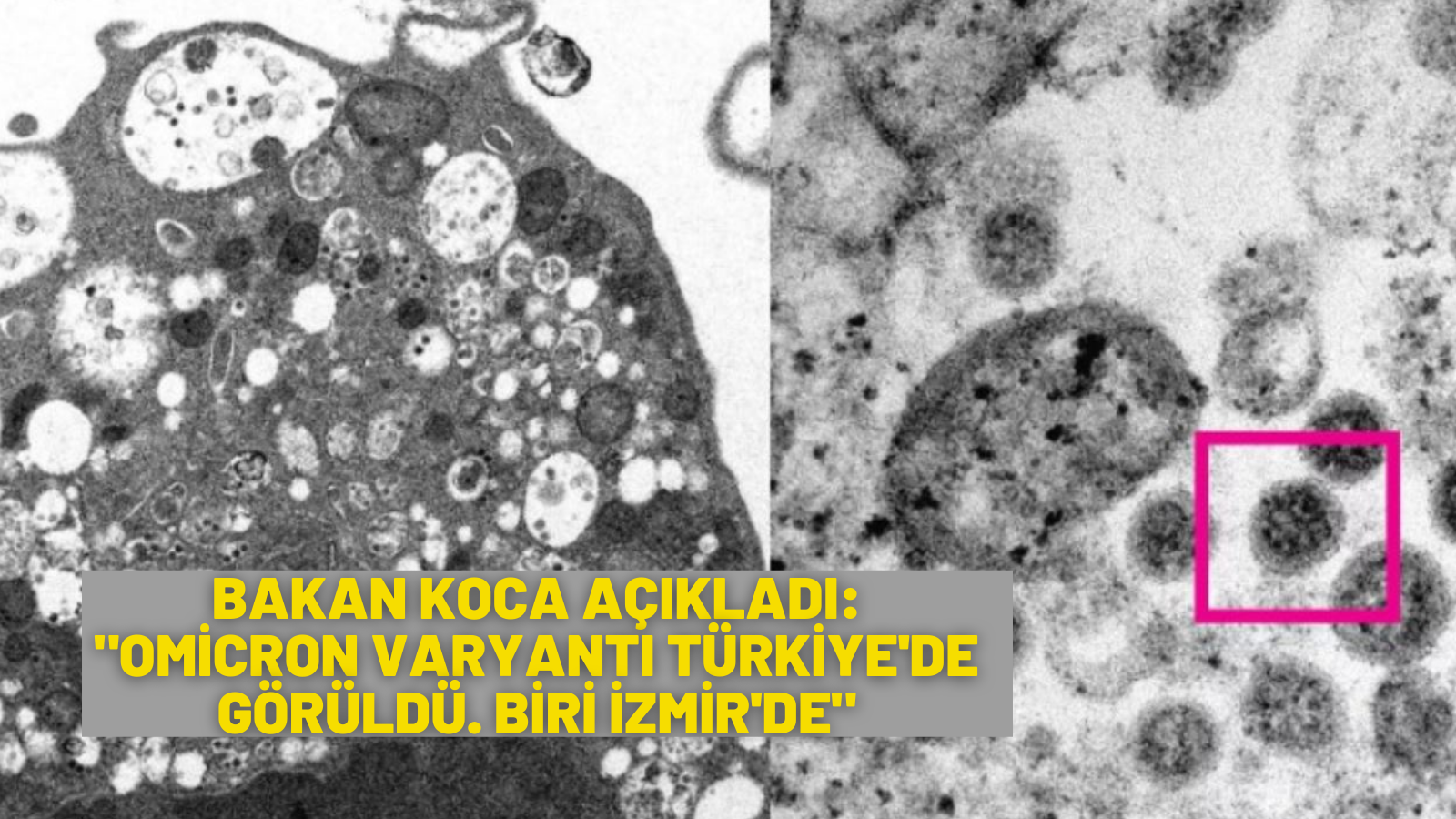 Omicron varyantı Türkiye’de 6 kişide tespit edildi