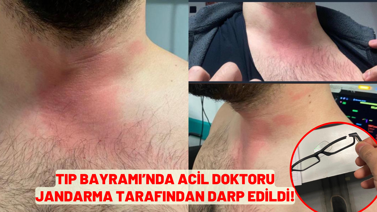 TIP BAYRAMI’NDA SAĞLIK ÇALIŞANI JANDARMA TARAFINDAN DARP EDİLDİ!