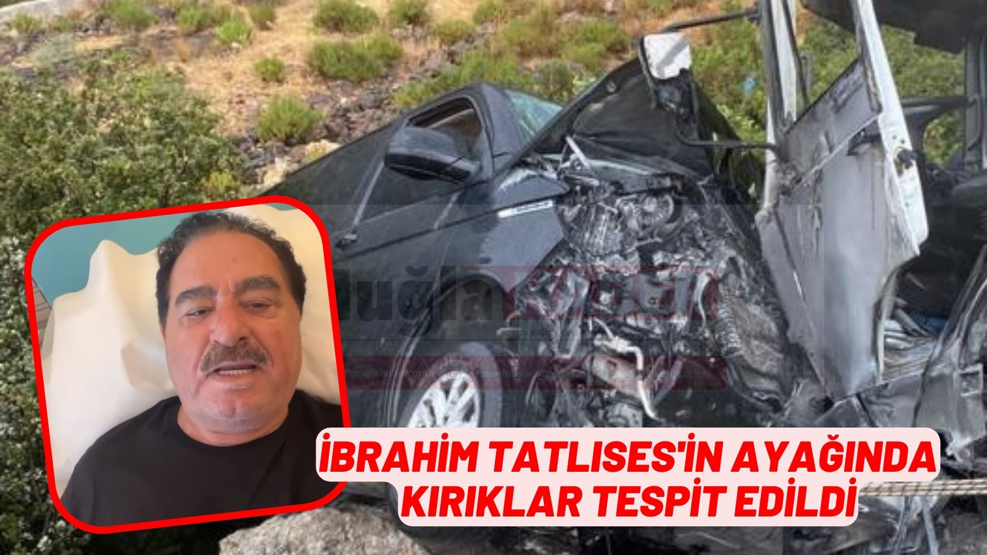 Bodrum'da trafik kazası geçiren İbrahim Tatlıses'in ayağında kırıklar tespit edildi