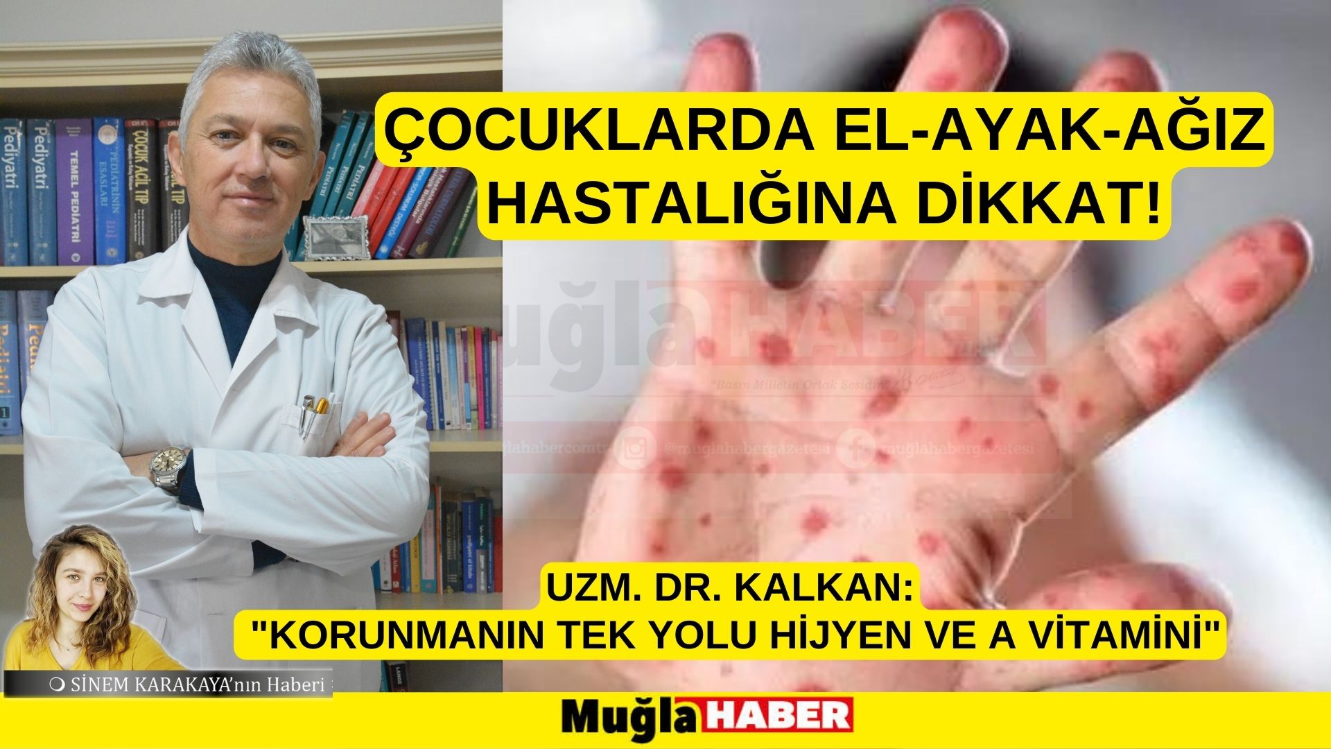 ÇOCUKLARDA EL-AYAK-AĞIZ HASTALIĞINA DİKKAT!