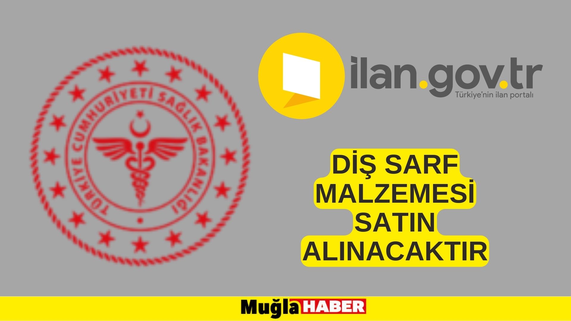 Diş sarf malzemesi satın alınacaktır