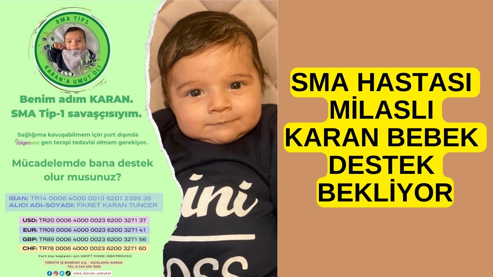 SMA HASTASI MİLASLI KARAN BEBEK DESTEK BEKLİYOR